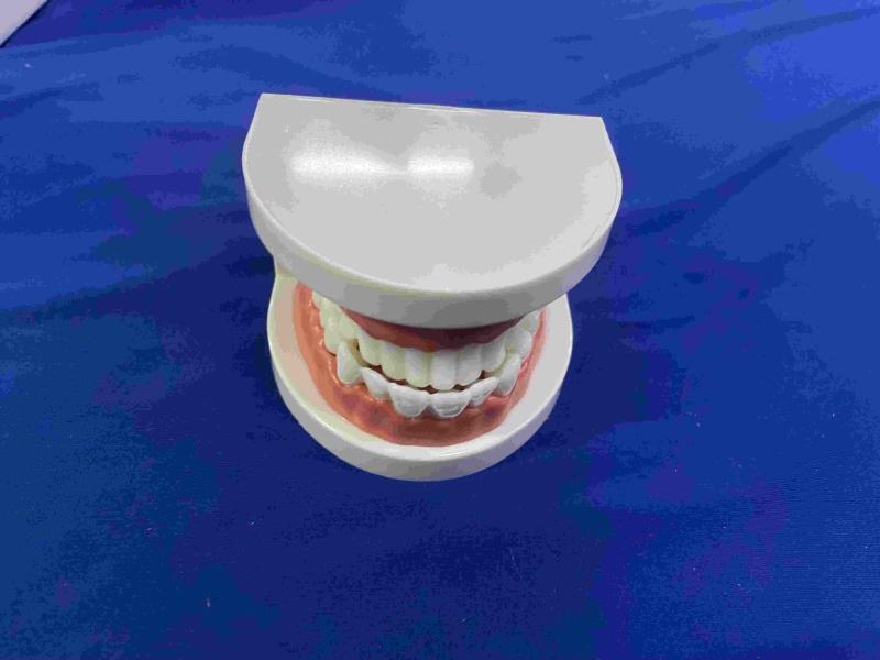 Rosenice Zahnmodell Dentalmodell, Standard Dentallehrung, Studium Typodont Demonstrationswerkzeug